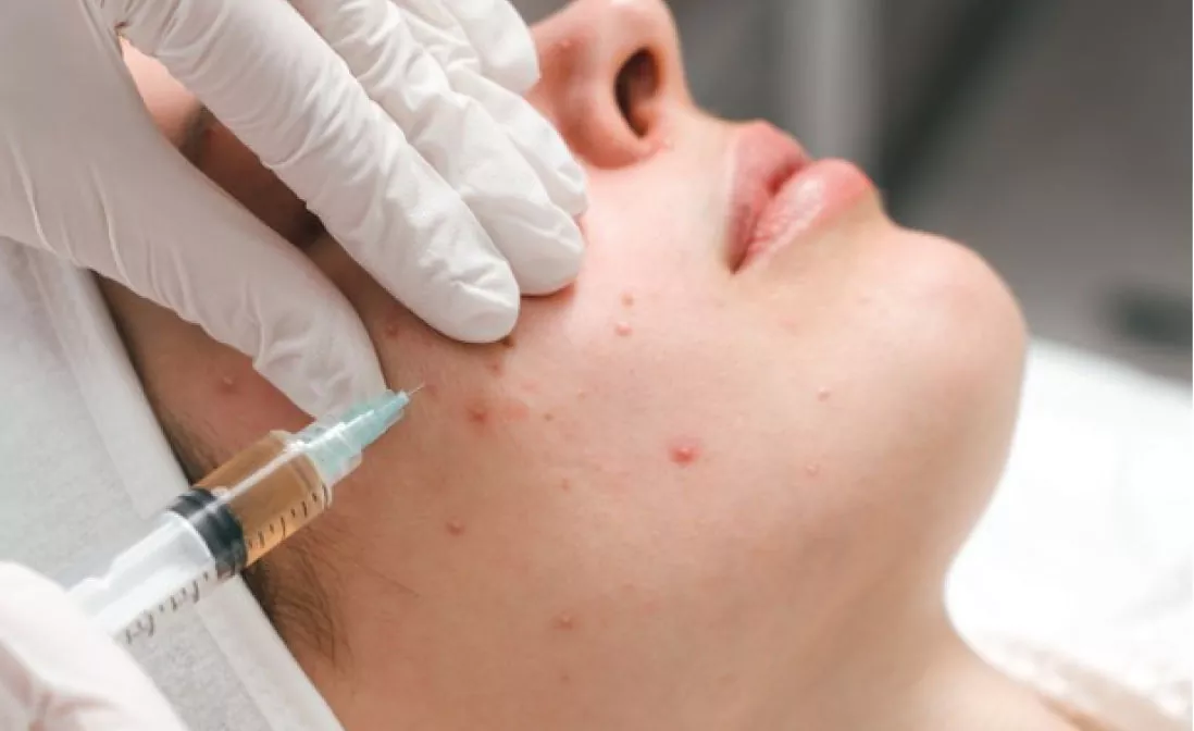 Aesthetic Dermatology